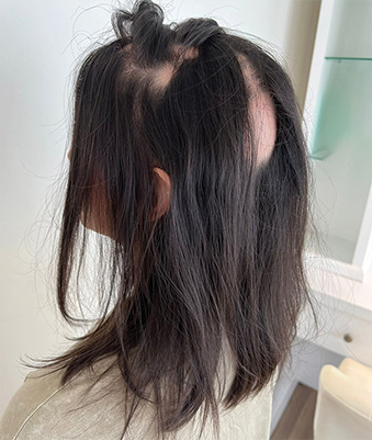 Explore Rootmesh Method